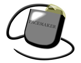 Pacemaker